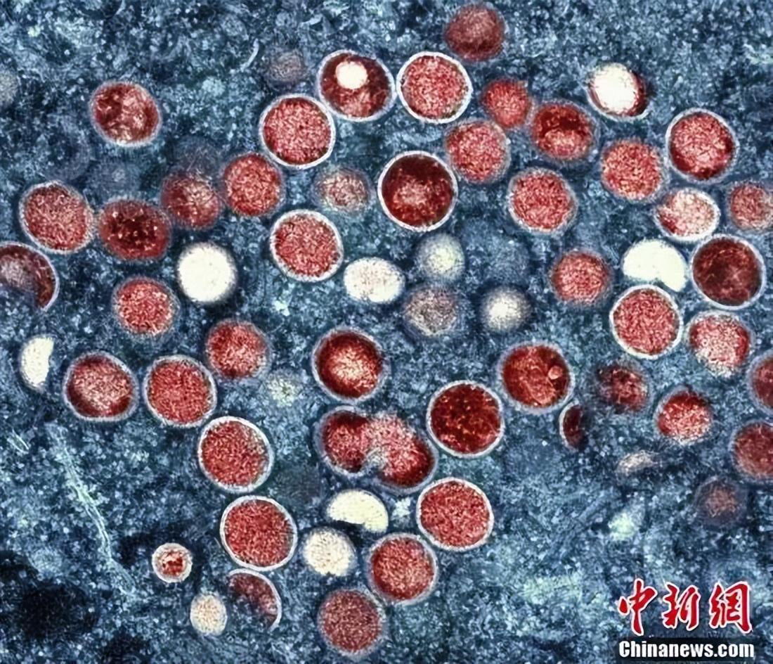 最新消息关于猴痘，全球疫情动态与应对策略，全球猴痘疫情动态，最新消息与应对策略