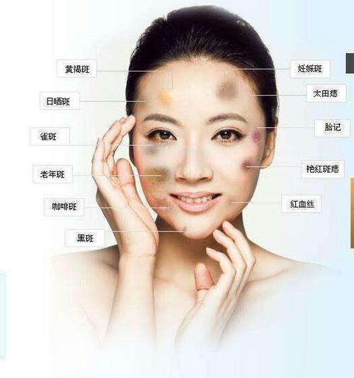 美白祛斑的最好方法，全方位解析与实用建议，美白祛斑最佳方法，全方位解析实用建议，告别色斑困扰！